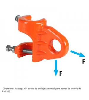 Anclajes temporales